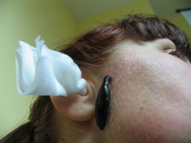 PIJAWKI hirudo medicinalis — zdjęcie 2
